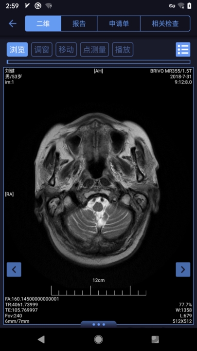 东软睿影移动办公