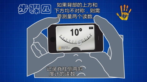 脊柱测量仪 HD v2.0