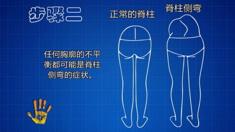 脊柱测量仪 HD v2.0